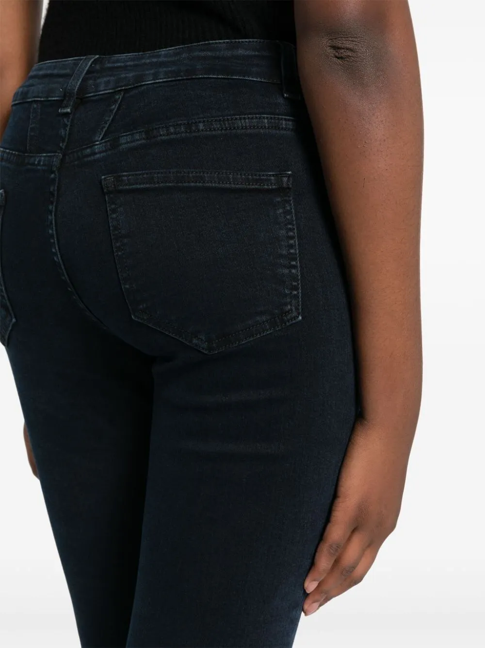 Baker Mid-Rise Skinny Jeans