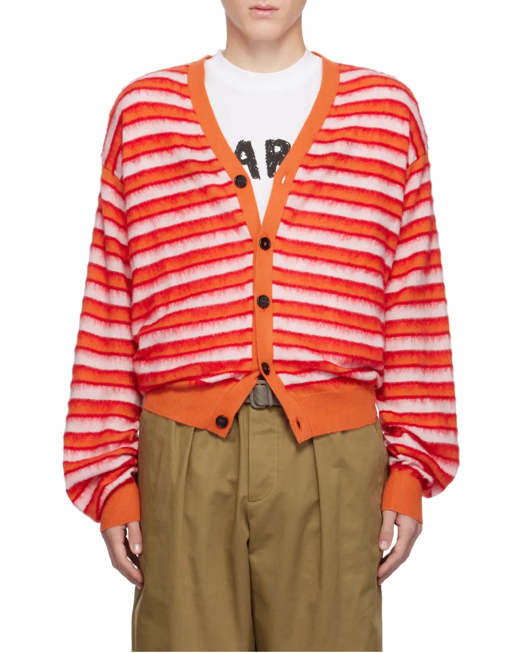 Striped Cardigan