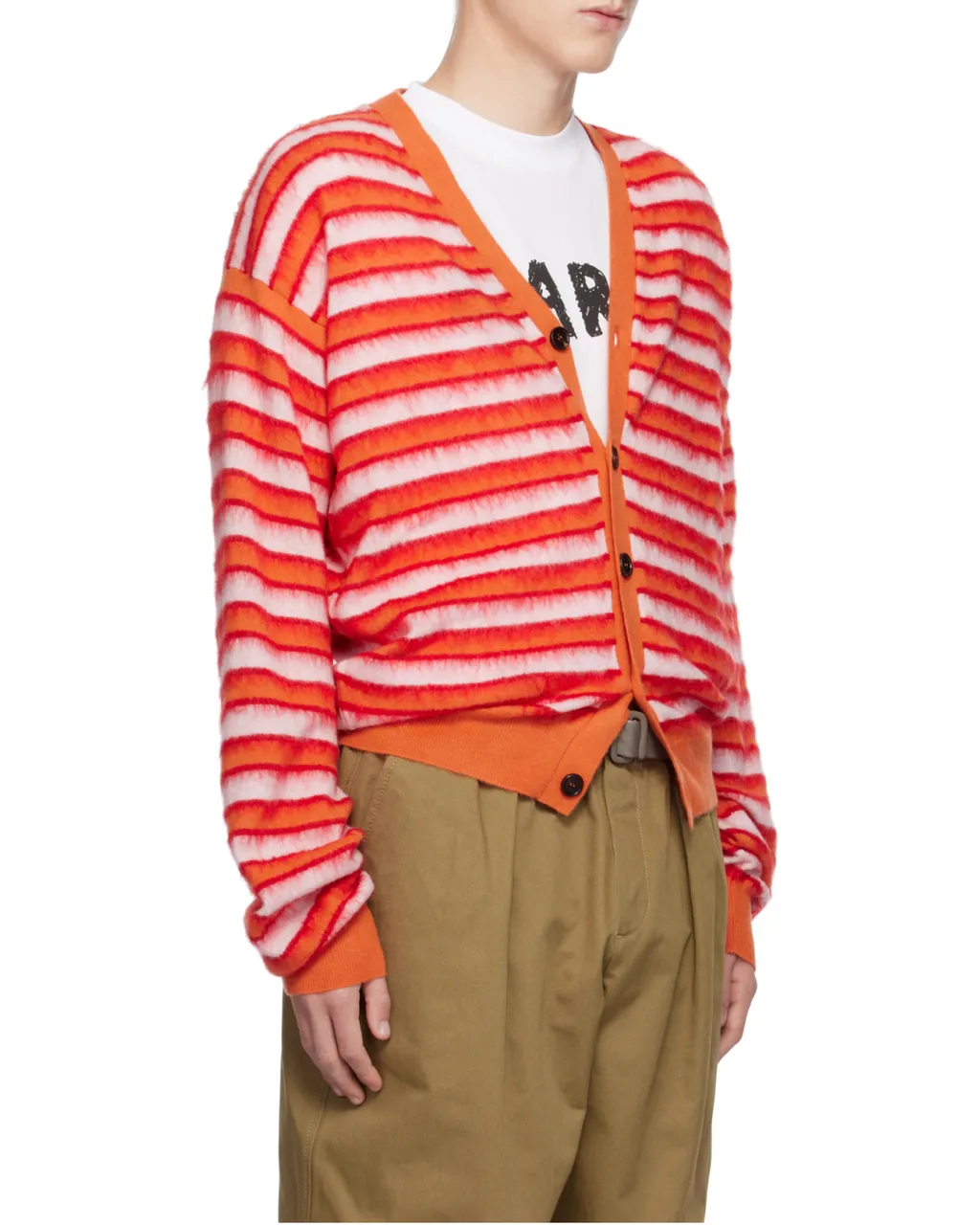 Striped Cardigan