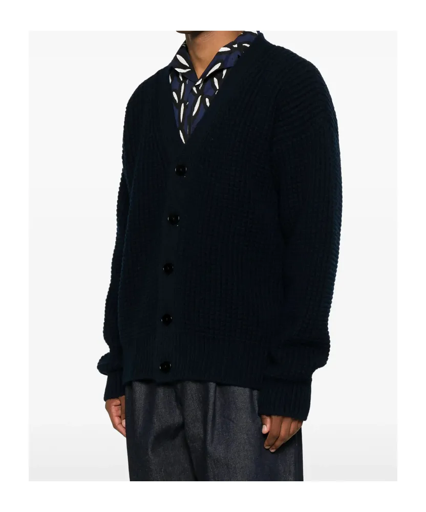 V-Neck Cardigan