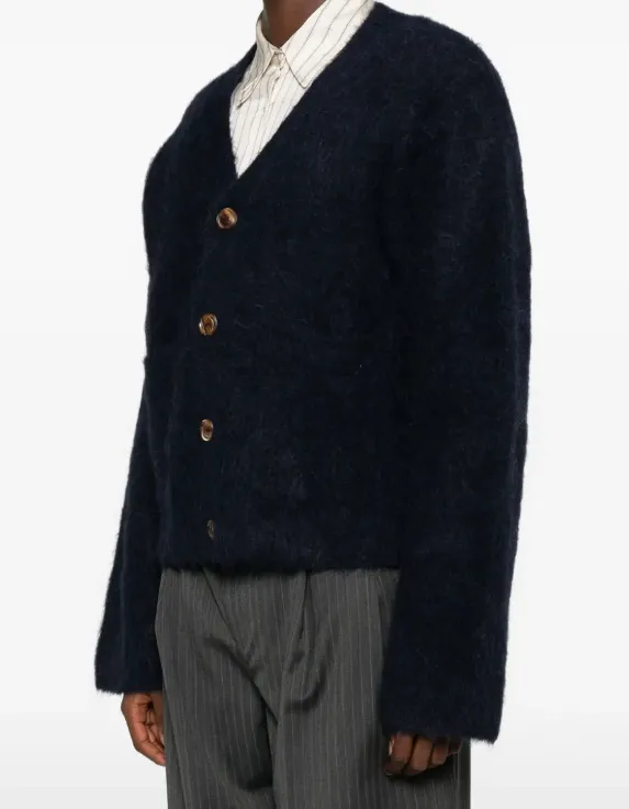 Button-Up Cardigan