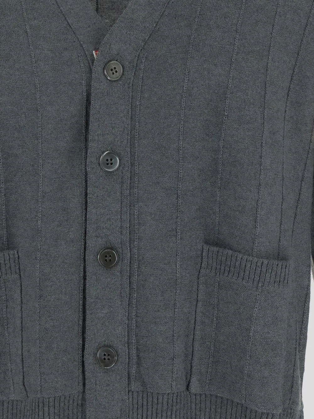 Stripped Buttoned Cardigan