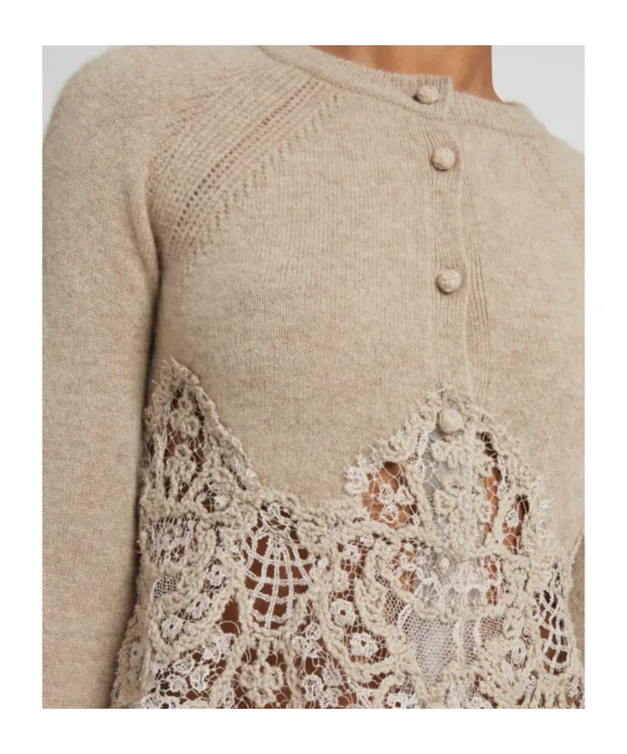 Lace-Trimmed Cardigan