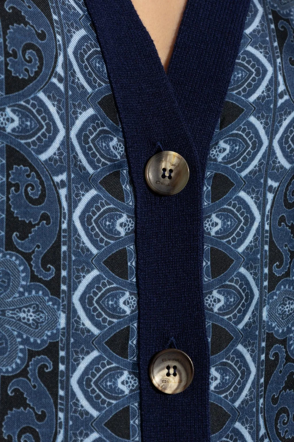 V-Neck Buttoned Cardigan