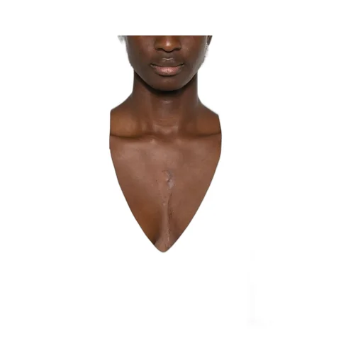 Sling Dress