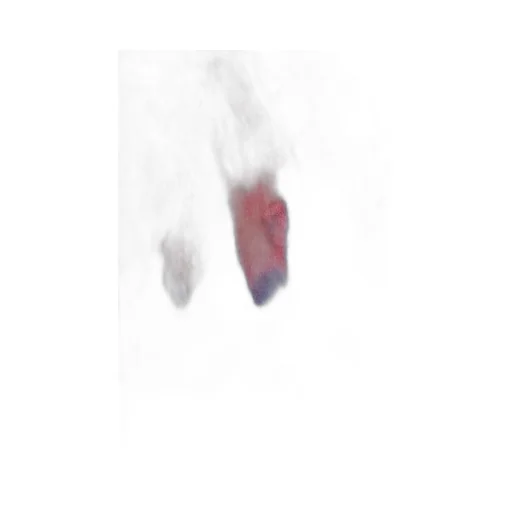 Logo Printed Tie Dyed Bermuda Shorts