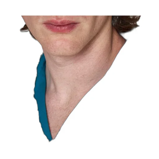 Marni Logo Printed Collar Ripped Vest